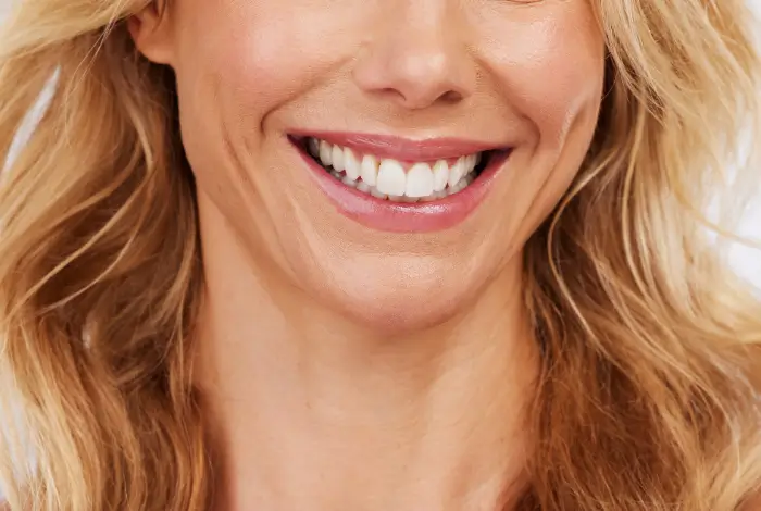 Close up of a woman smiling with flawless veneers in San Antonio